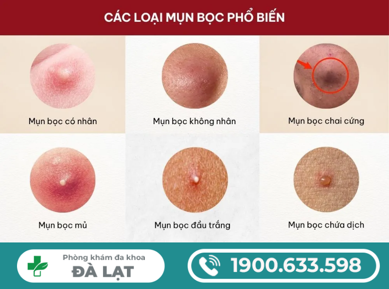 Hình ảnh minh họa